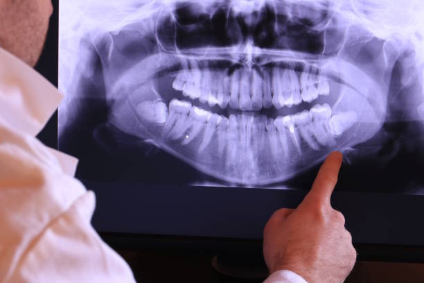 Best After-Hours Emergency Dentist in Marshfield, WI
