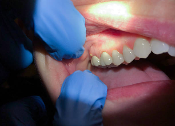 Best Emergency Dental Care for Trauma or Injury in Marshfield, WI