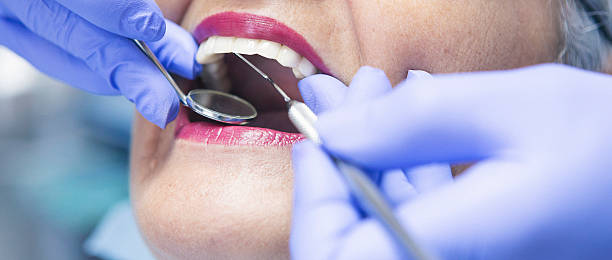 Best Walk-In Emergency Dentist in Marshfield, WI